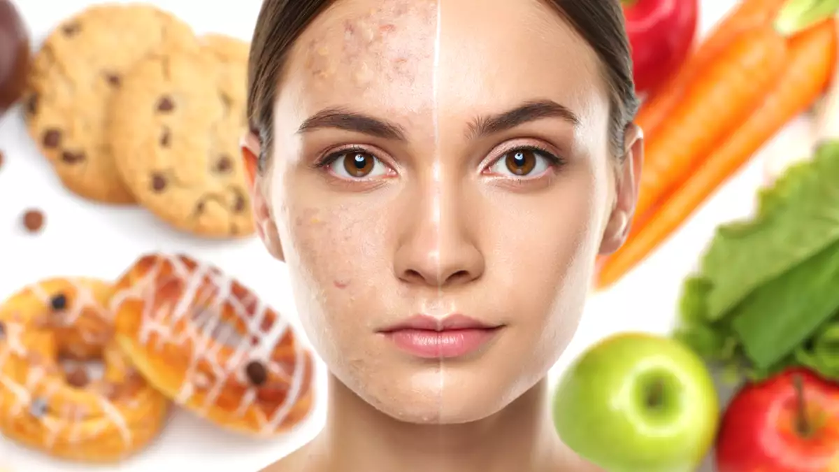 These common foods might be why your skincare routine isn’t working: here’s what to cut